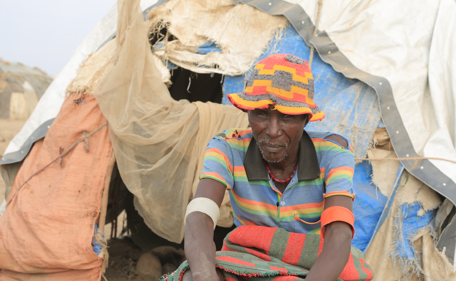 Amid a hunger crisis in East Africa Adoko Hatoro Engang sits in front of a tent, his temporary home.  Drought and flash floods have forced him to leave his village with his family